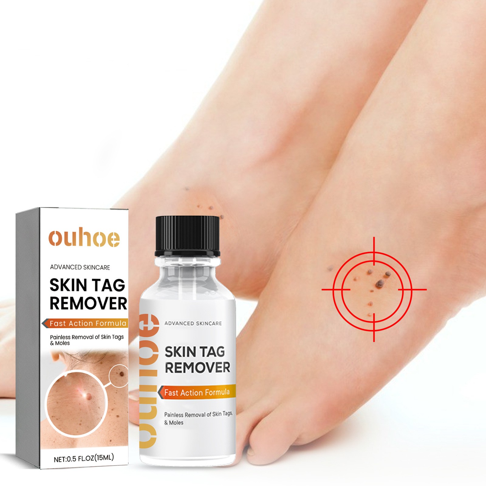 Cleansing Skin Wart Fading Black Mole Corns Mild And Smooth Skin Care Solution