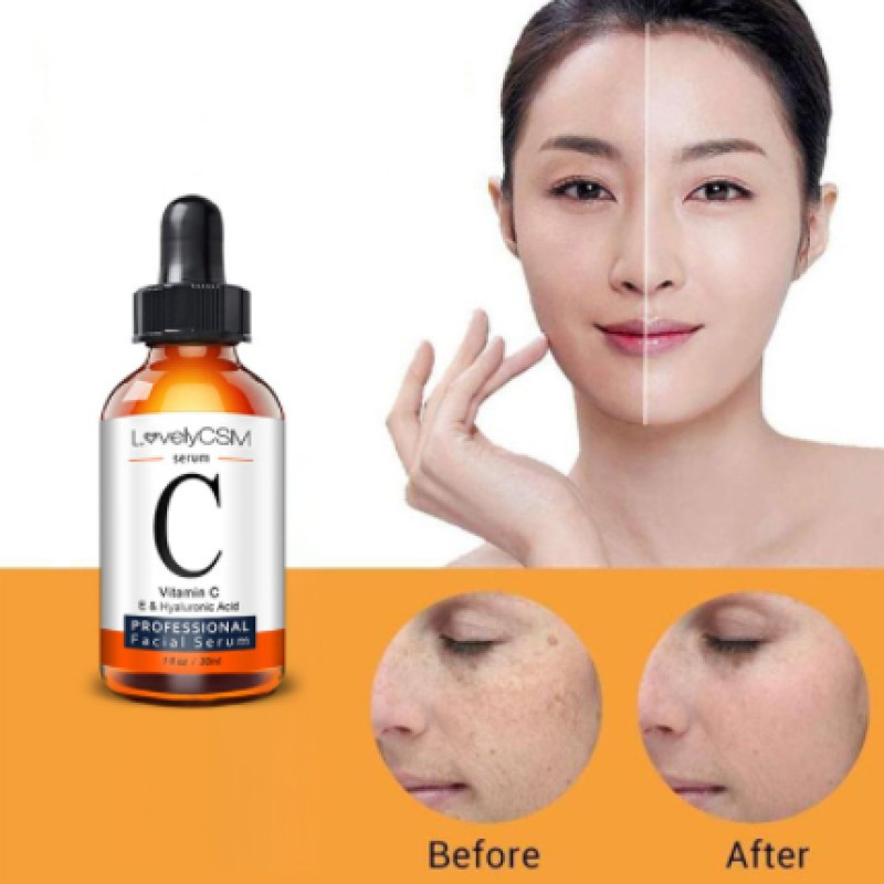 LovelyCSM Vitamin C Serum