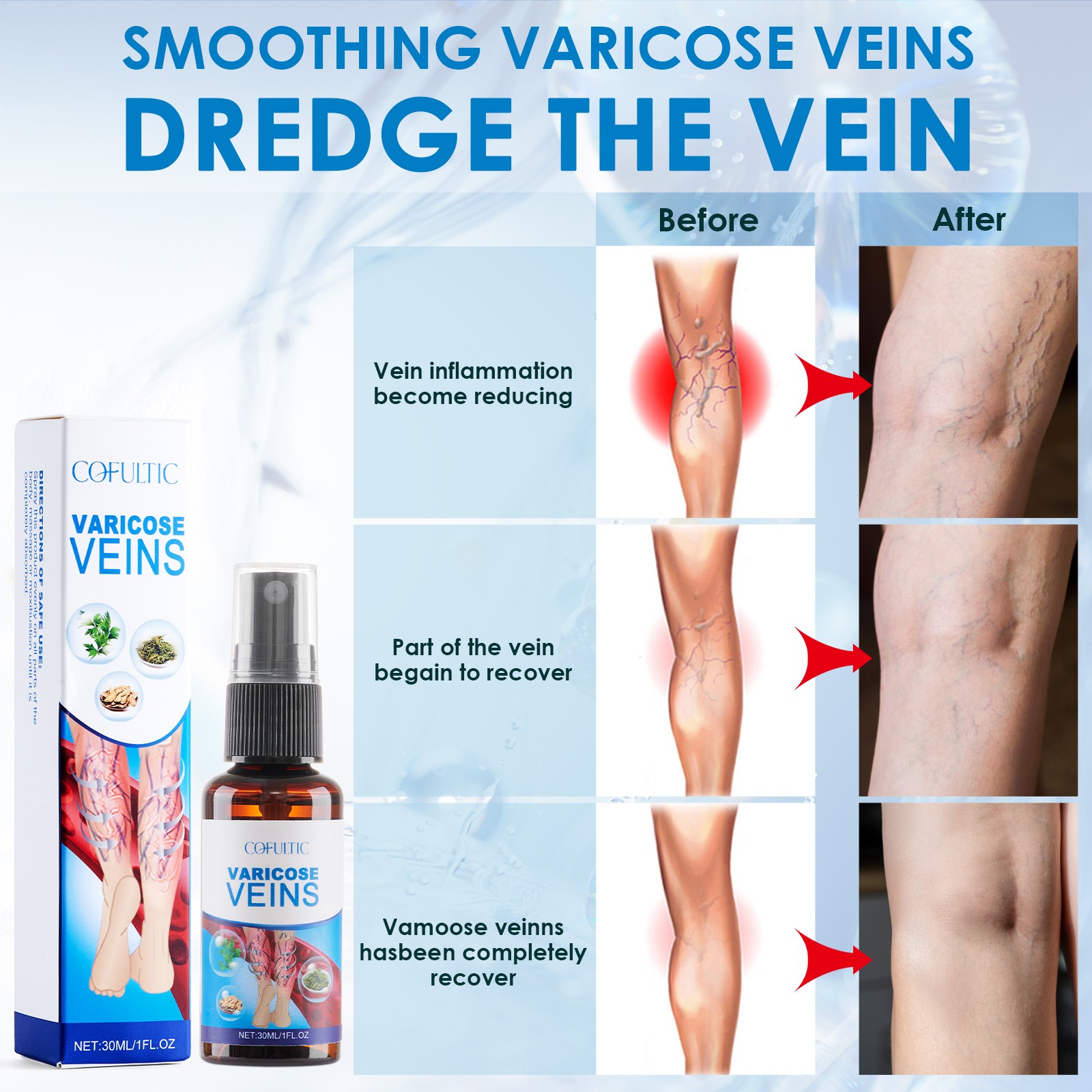 30ml Varicose Vein Spray