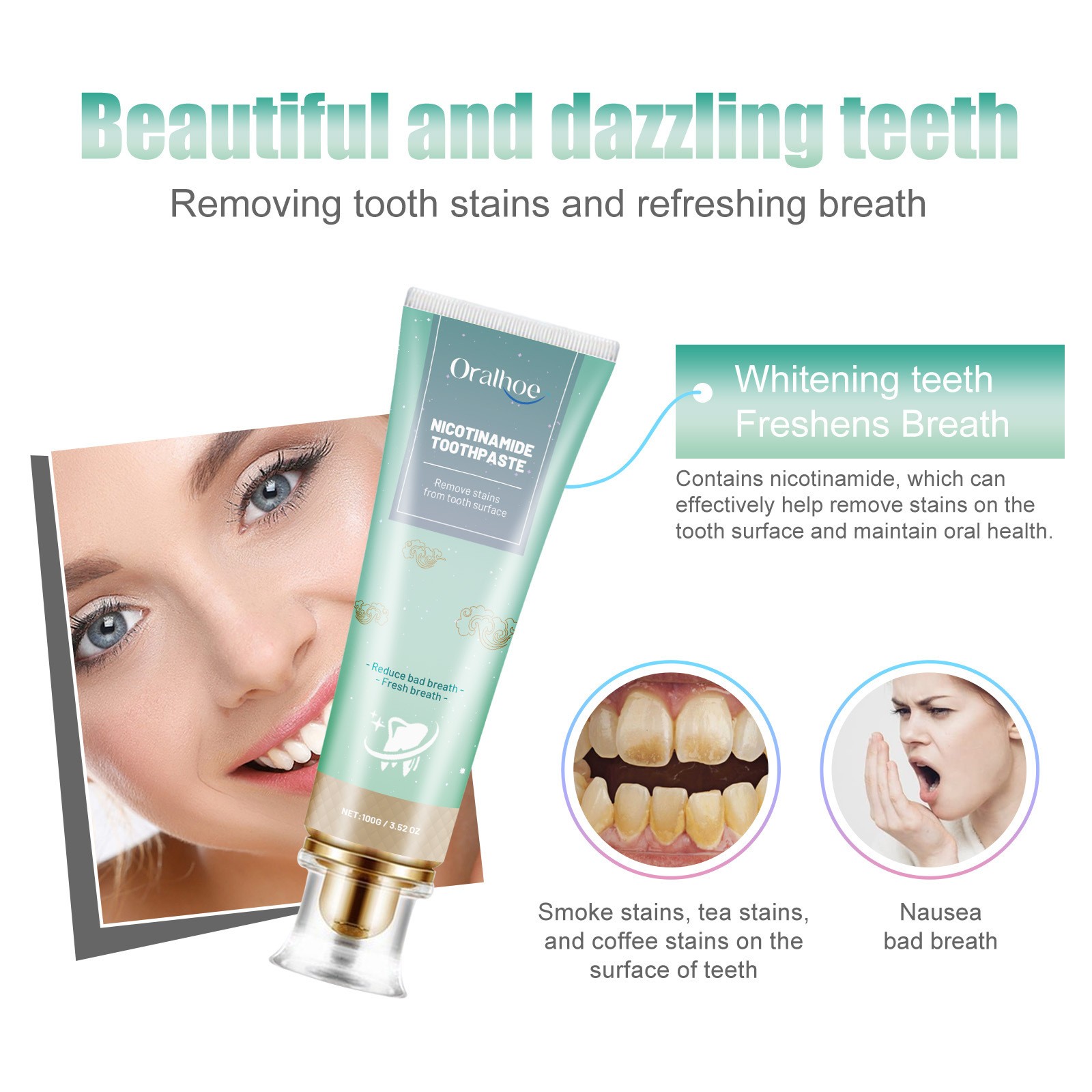 Oralhoe Nicotinamide Toothpaste Freshen Your Breath, Whiten Your Teeth