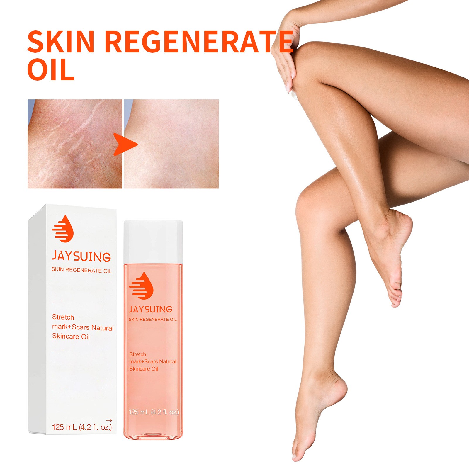 Jaysuing Skin Regenerate Oil Stretch Mark & Scar Treatment