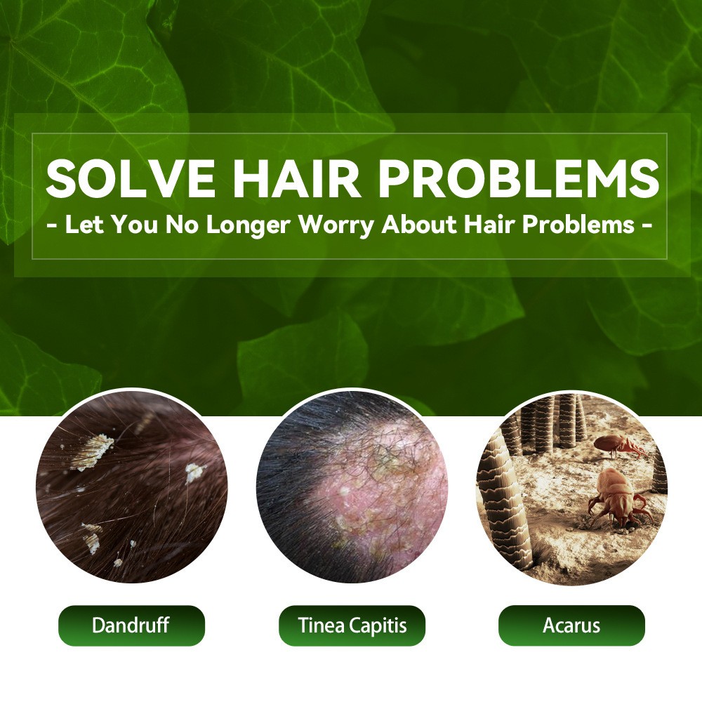 EELHOE Plant Formula Antipruritic Hair Shampoo Dandruff Control & Hair Follicle Protection