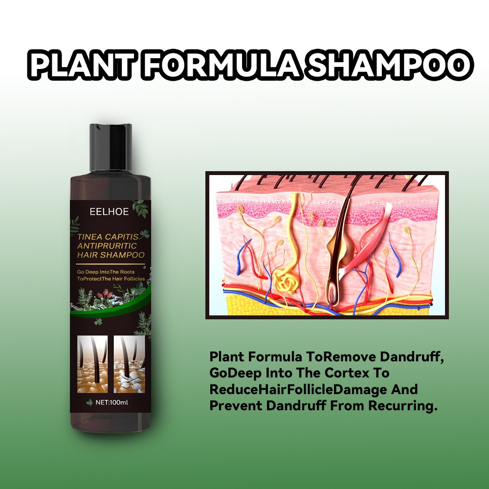 EELHOE Plant Formula Antipruritic Hair Shampoo Dandruff Control & Hair Follicle Protection