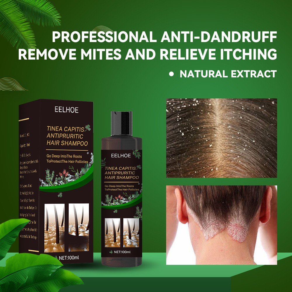 EELHOE Plant Formula Antipruritic Hair Shampoo Dandruff Control & Hair Follicle Protection
