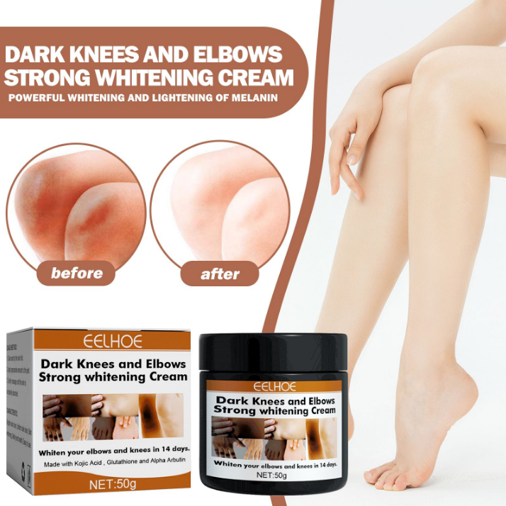 Eelhoe Dark Knees and Elbows Strong Whitening Cream - 50g