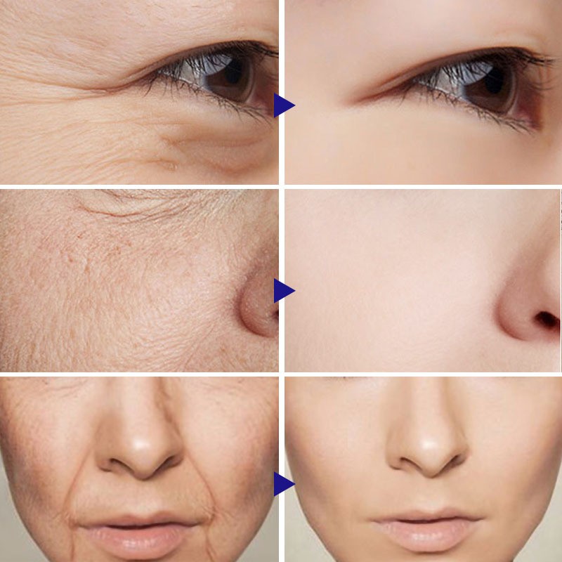 VOVA Vitamin C Serum Professional Facial Serum for Radiant, Youthful Skin