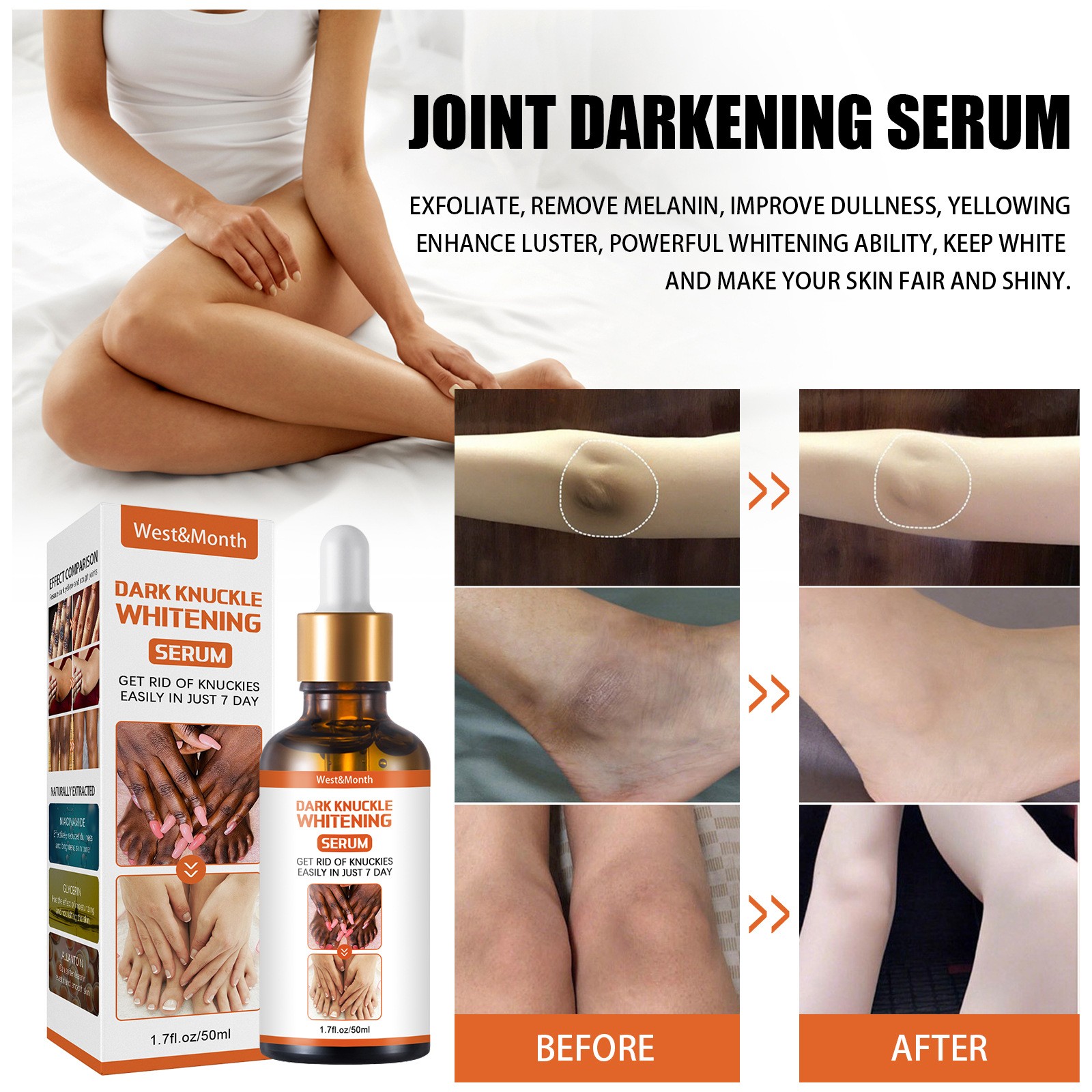 West&Month Dark Knuckle Whitening Serum