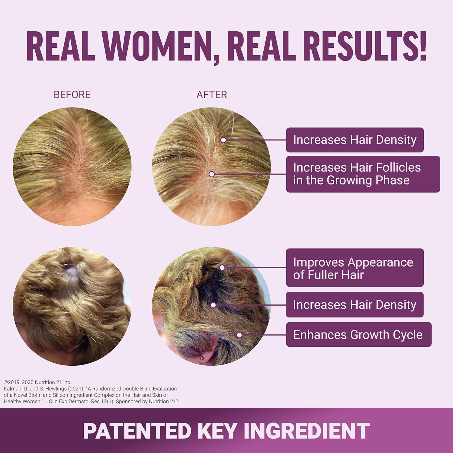 Hair Growth Accelerator  Promote Thicker, Fuller, and Healthier Hair Naturally