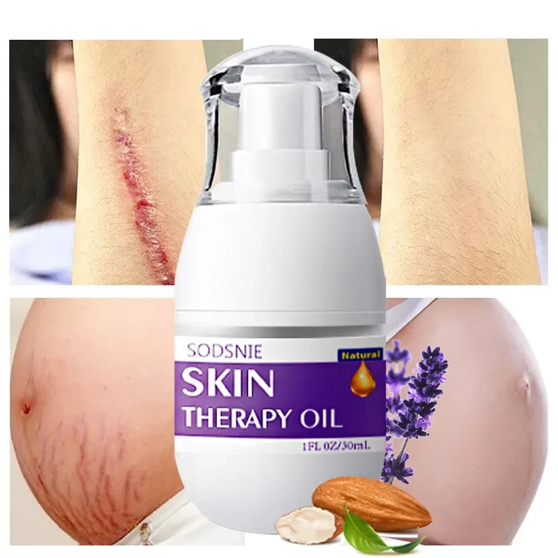 Treatment Oil Remove Puncture Cellulite Stretch Mark