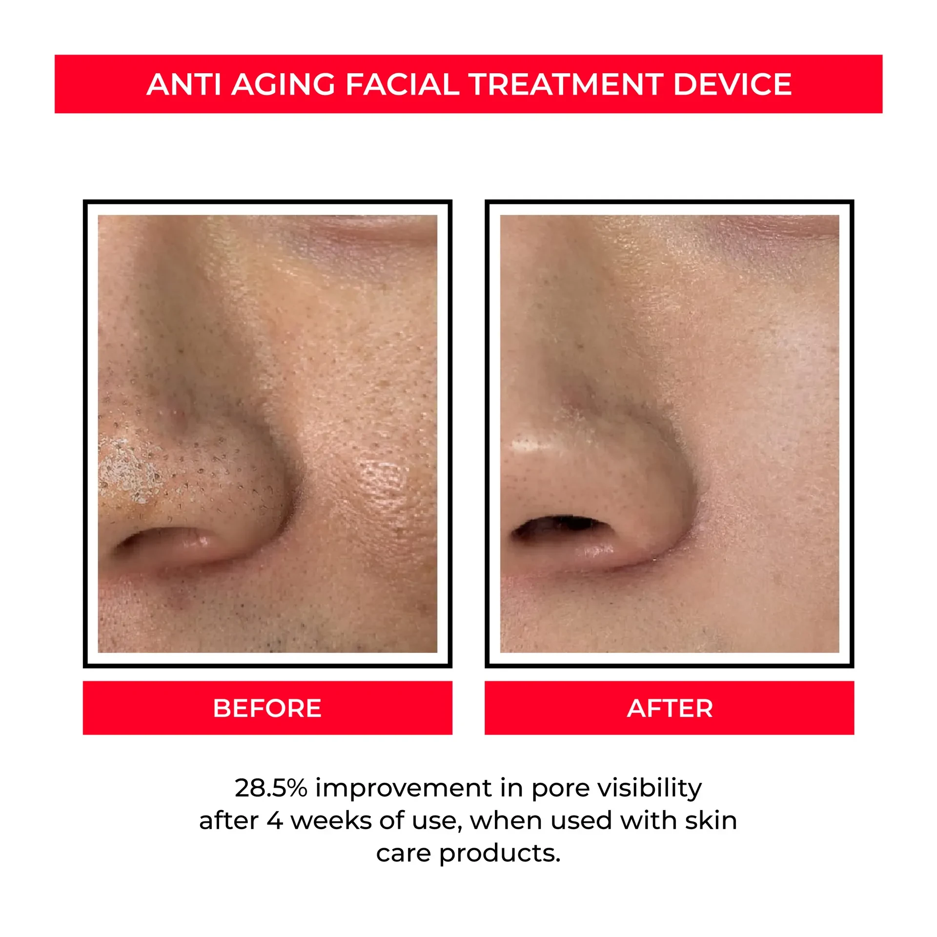 EMS Skin Rejuvenation Device with Microcurrent for Pore Tightening and Skin Firming
