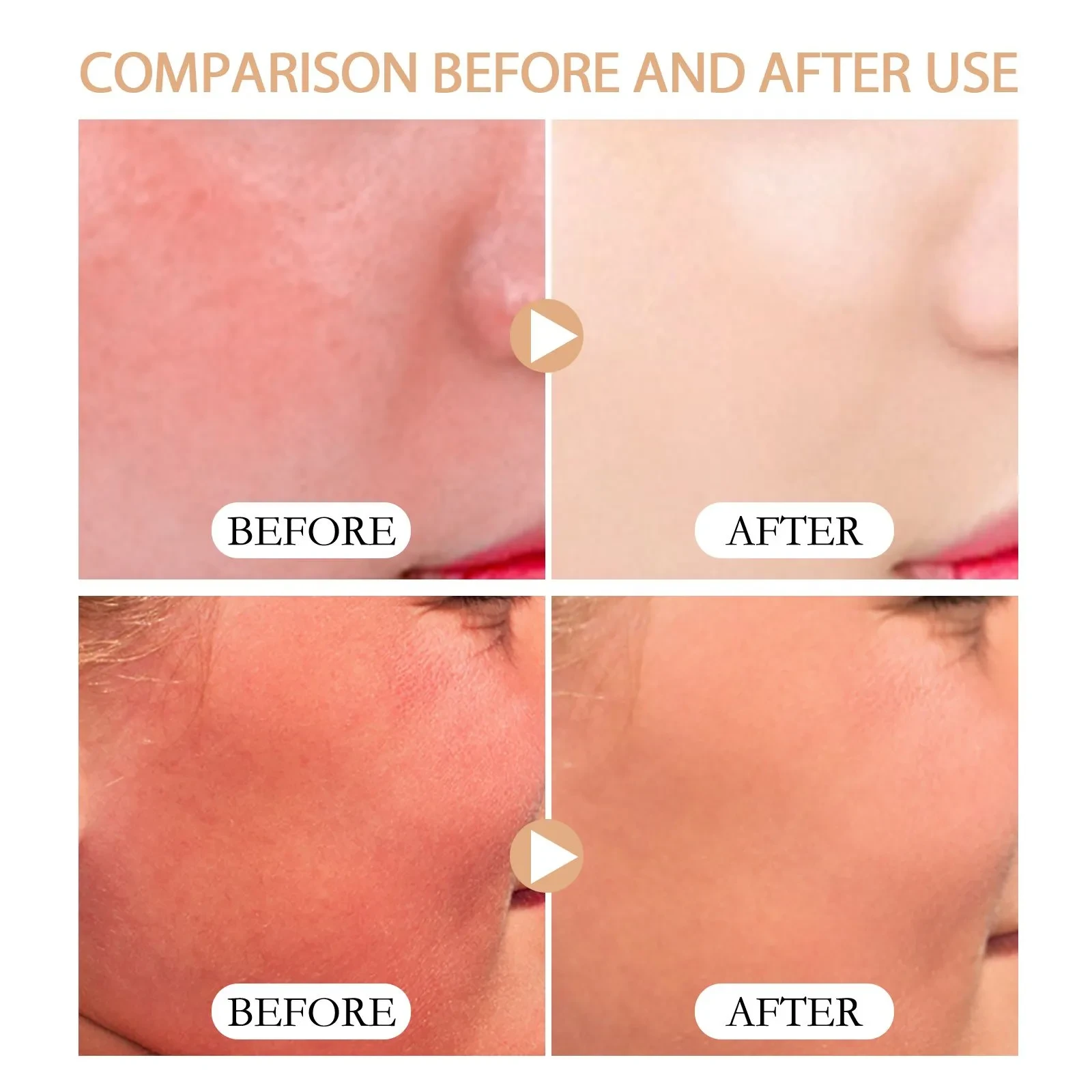 Natural UV Protection And Sunburn Prevention