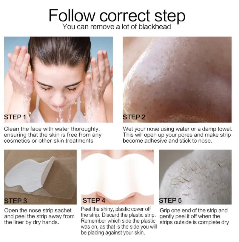 Removing Blackheads And Pimples Cleaning Nose Patches