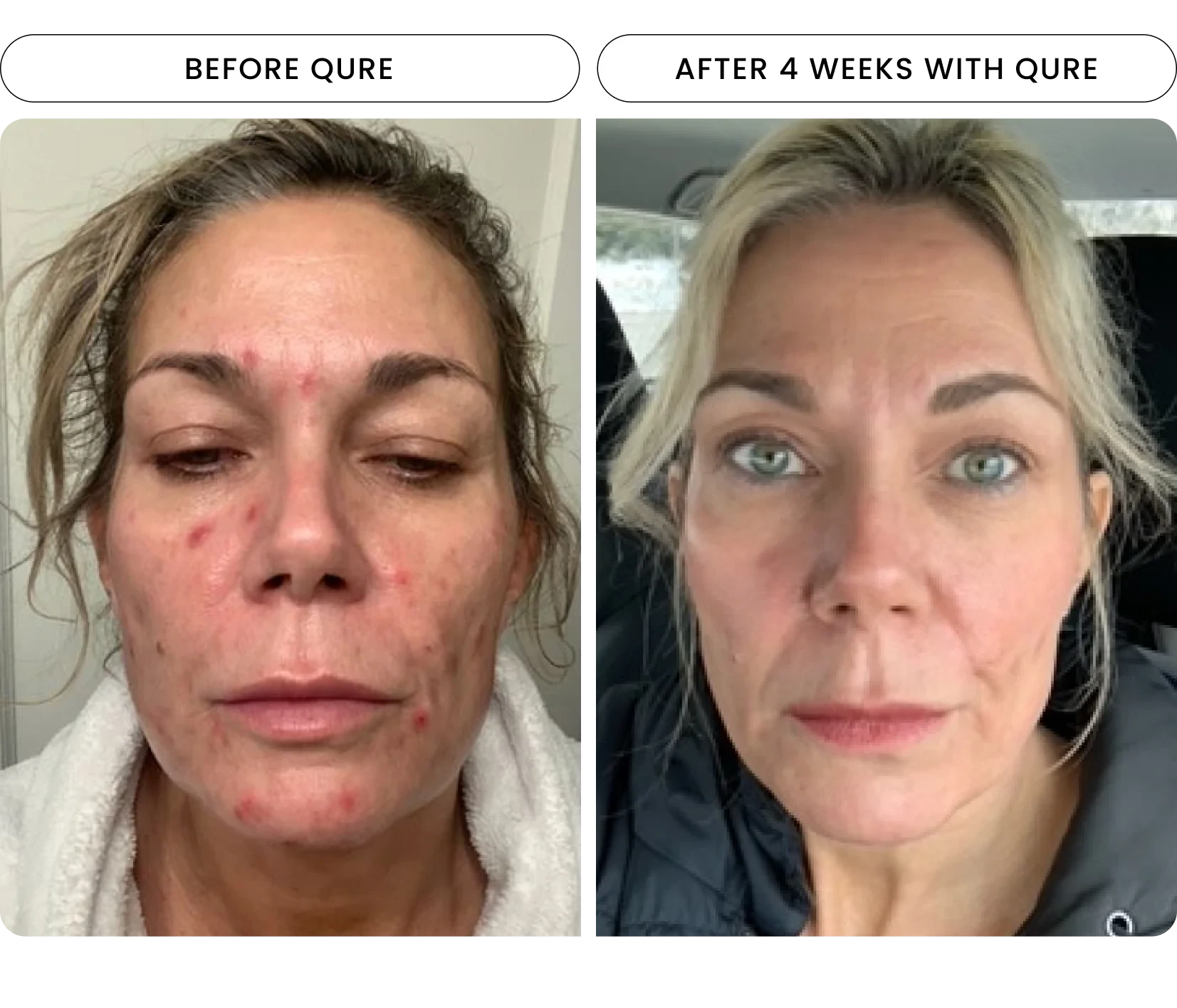 Repair & rejuvenate your skin with our Light Therapy Mask