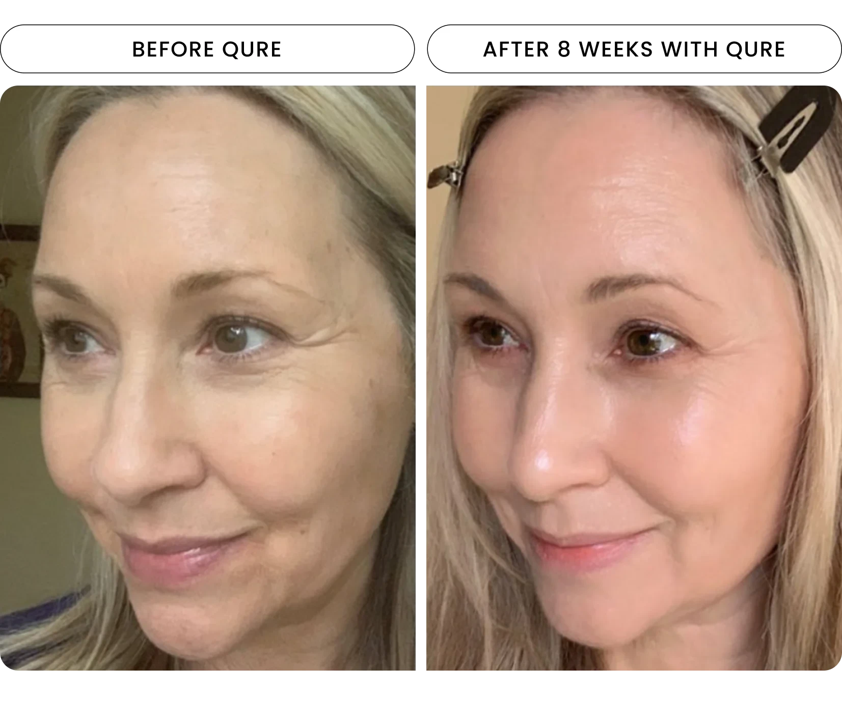 Repair & rejuvenate your skin with our Light Therapy Mask