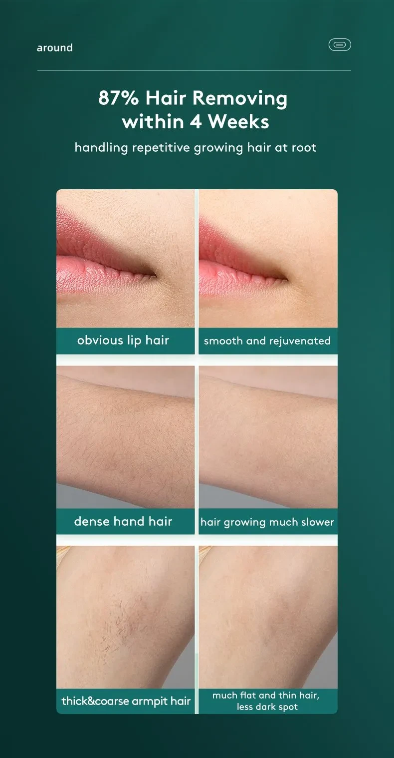 Laser Hair Removal Device With Ice Cooling Function