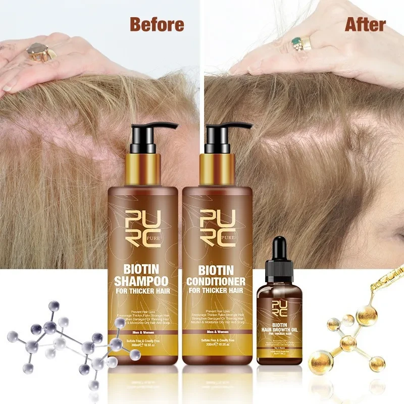 PURC Hair Ginger Biotin Three-piece Shampoo Conditioner