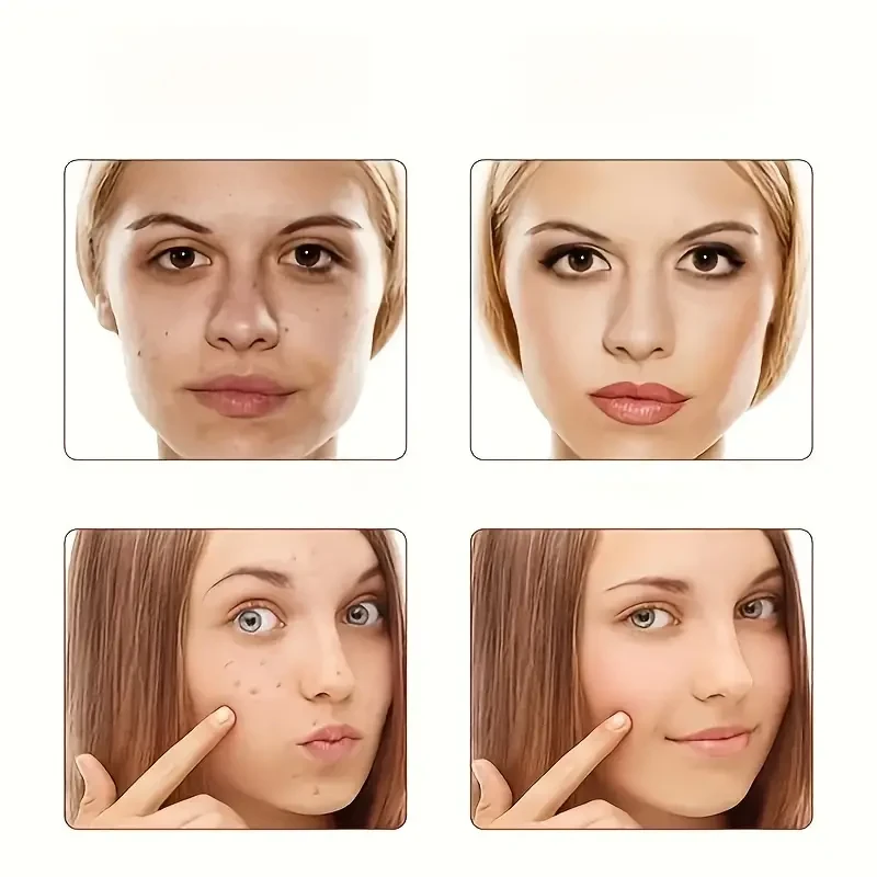 30g Spot Cream - Face Moisturizer for Sunburn, Freckles, Color Spots, Age Spots, Dark Yellow Skin - Disintegrate Melanin, Restore Smooth, Radiant and Even-Toned Skin