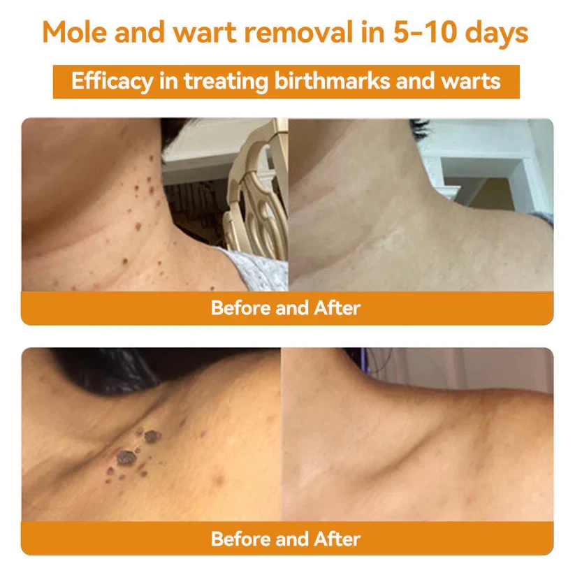 LOVILDS Bee Venom Skin Treatment CreamHealth Canada Approved