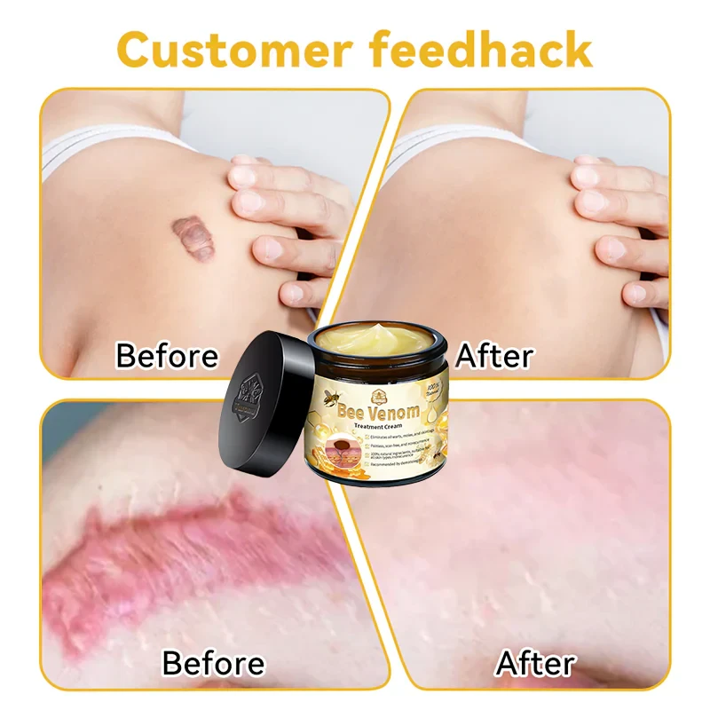 LOVILDS Bee Venom Skin Treatment CreamHealth Canada Approved