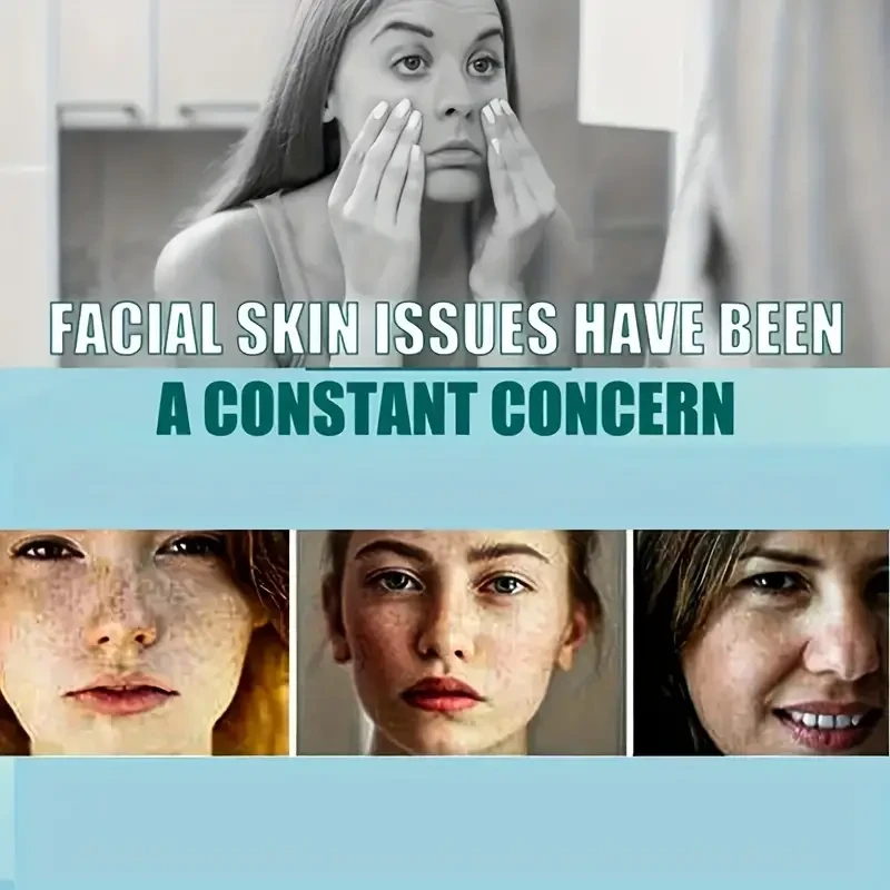 Moisturizing Dark Spot Remover For Face And Body - Repairs And Smooths Skin, Non-Irritating, Easy Absorption, Non-Greasy - Perfect For Skin Maintenance