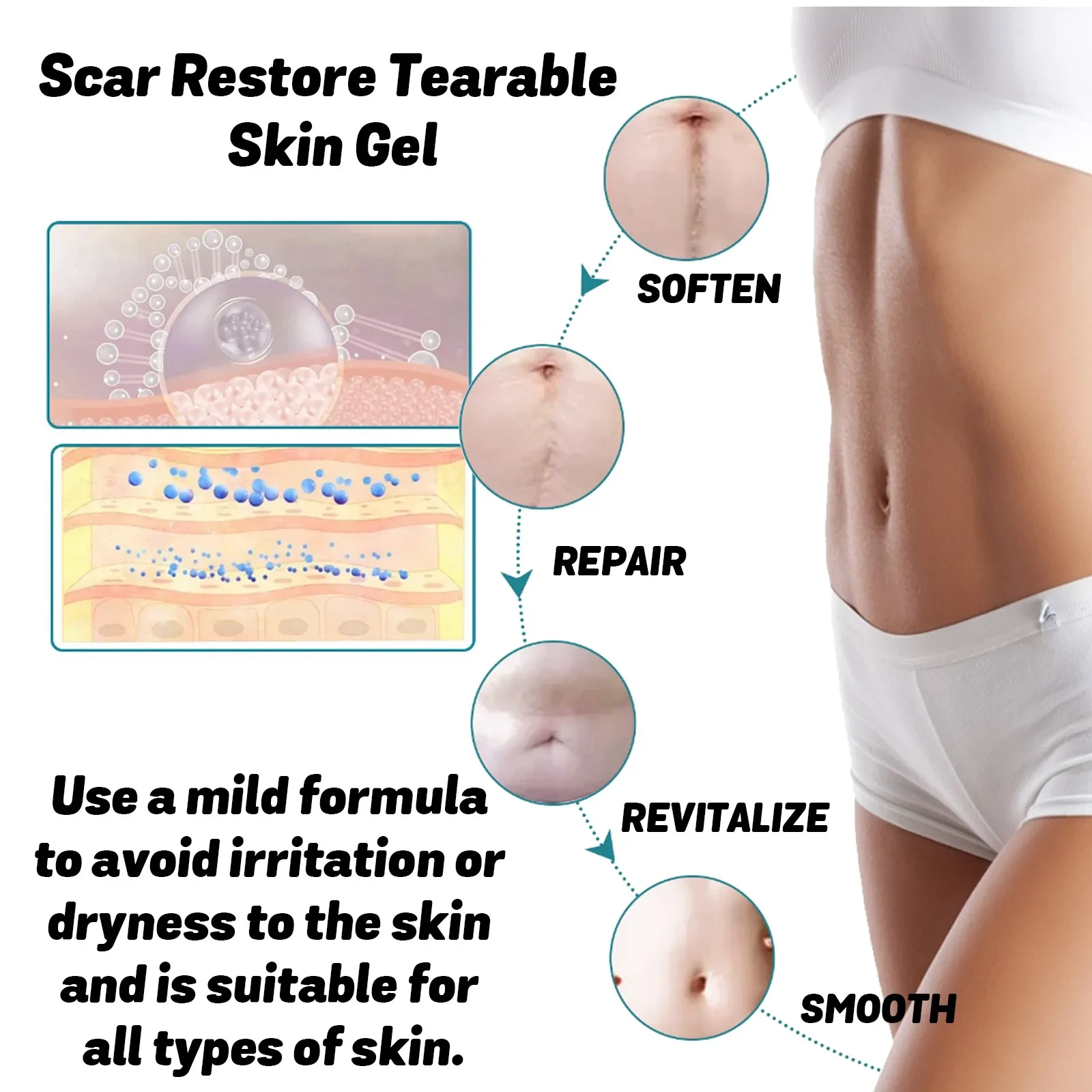 Skin Thinning Care Gel For Scar