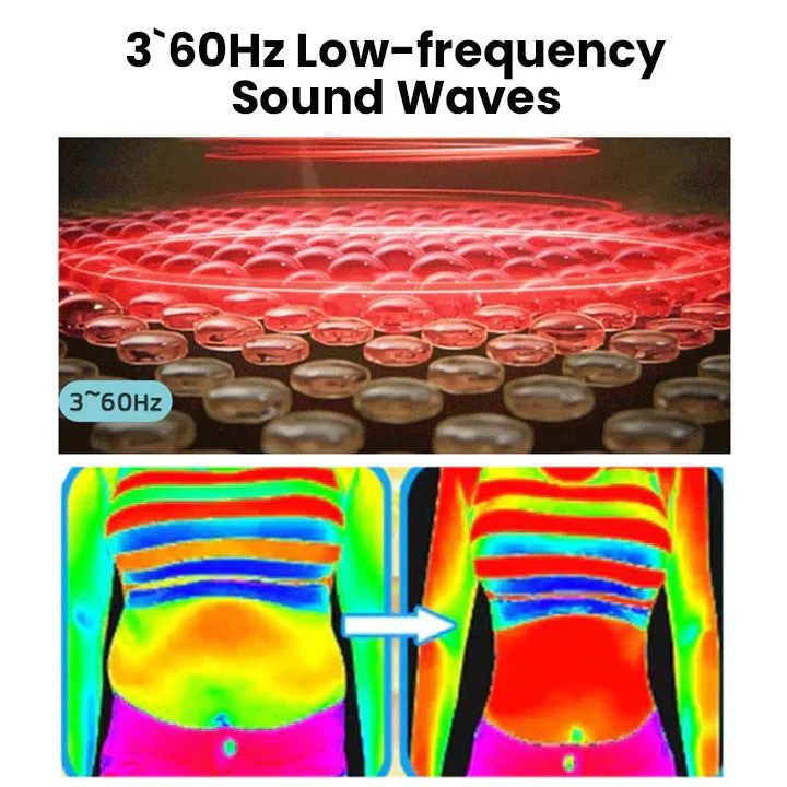 Seurico Matteo Ultrasonic Body Shape Wristband Pro