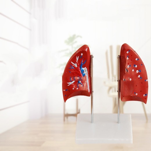 Lung Anatomical Model Lung Segment Model Respiratory System Model