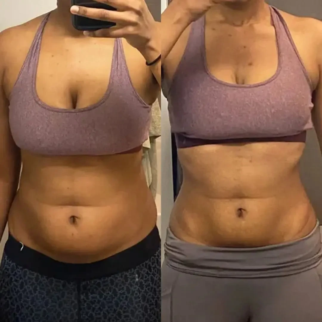 Sonicfit Ultrasonic Cavitation