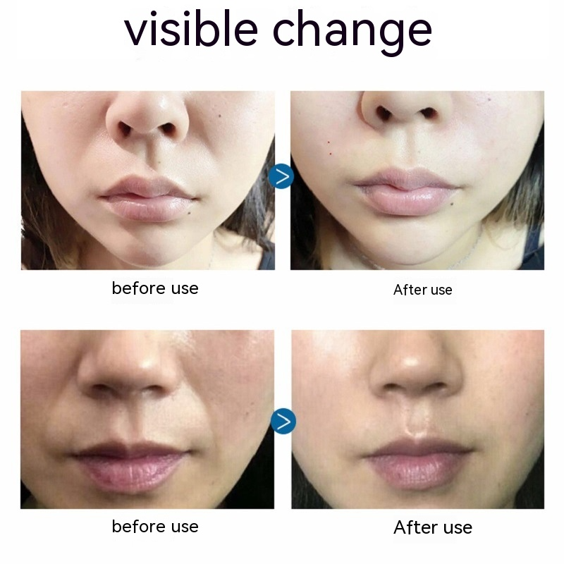 Lifting Anti-wrinkle Firming Hydrating And Reducing The Fine Lines Hydrogel French Patch