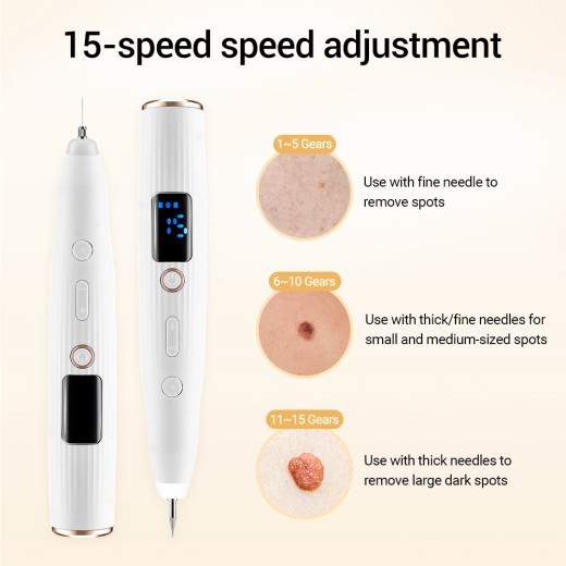 Mole Removal PEN 15-gear Adjustment Screen Spot Removal Mole Removal Instrument