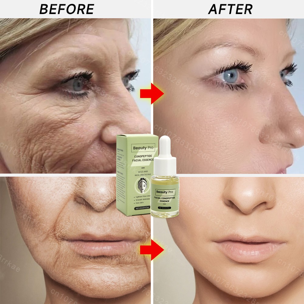 Wrinkles Removal Face Serum - Firming and Lifting Anti-Aging Essence