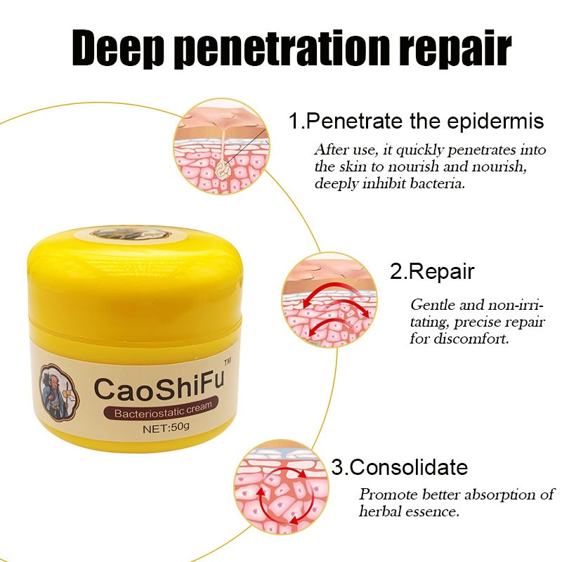 Caoshifu Psoriasis Cream - 4pcs 50g Herbal Skin Ointment