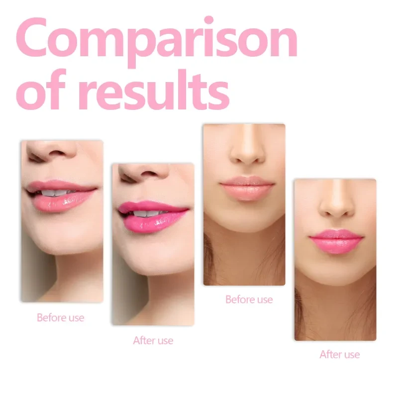 Lips Nourishing Moisturizing Lip Care