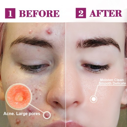 Light Licorice Pore Liquid Product AliExpress Supply