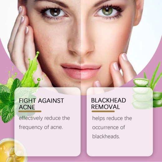 EELHOE Mild Improvement Of Salicylate Acne Cream