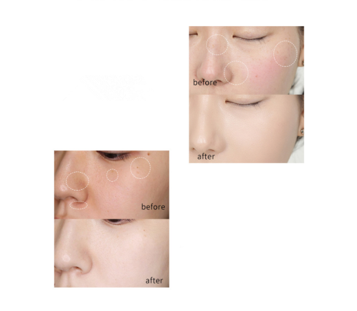 Fade The Spots And Brighten The Skin Cream