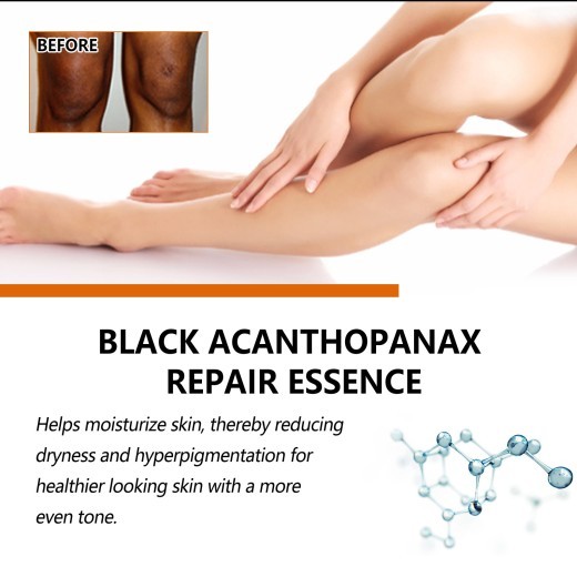 Black Ratchet Repair Joint Black Whitening Brightening