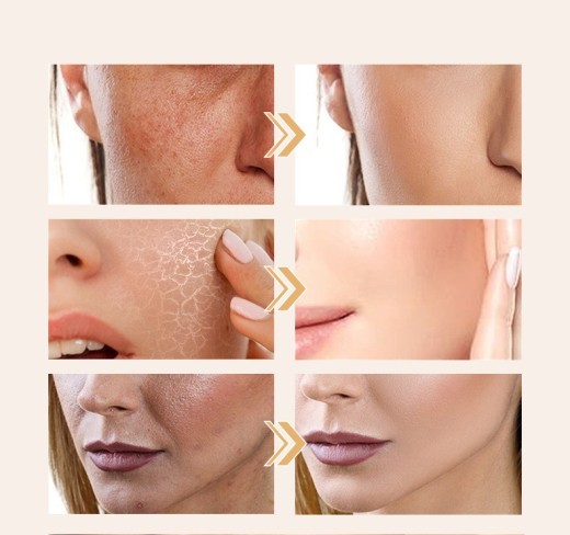 Full English Style Vitamin C Capsules Fading Wrinkle