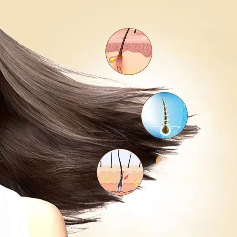 Sulfur Shampoo for Lice, Mites, Dandruff, and Itching  Oil Control, Deep Cleaning, Damage Repair