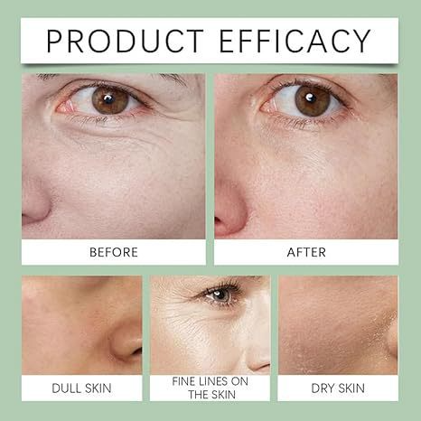 Noni Fruit Essence Moisturizes And Hydrates The Skin