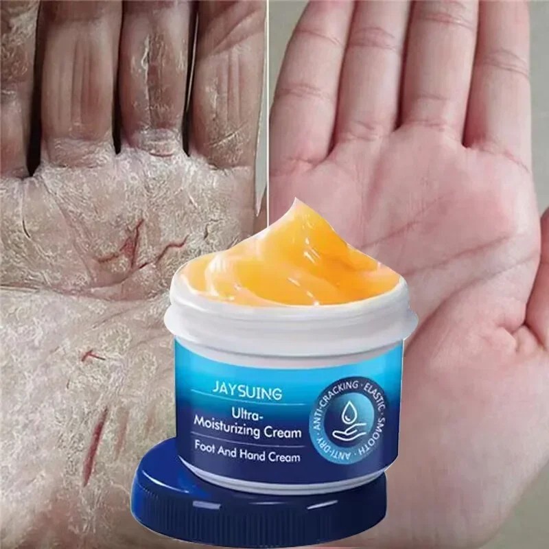 Anti-Drying Crack Hand and Foot Care Cream