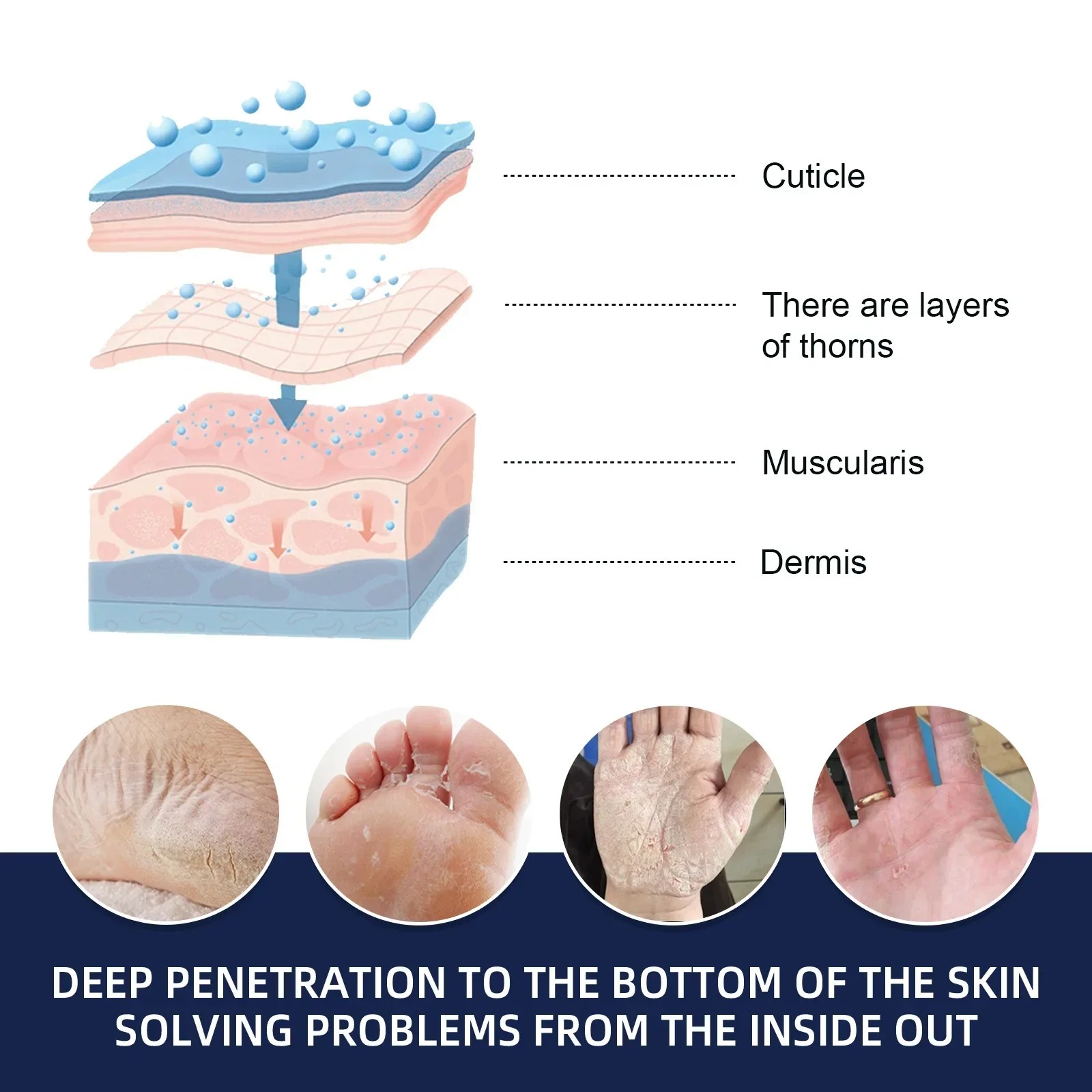 Anti-Drying Crack Hand and Foot Care Cream