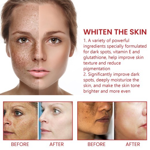 Black Spot Repair Cream Fading Wrinkle