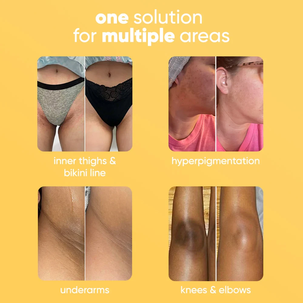 lemon turmeric & kojic acid brightening soap